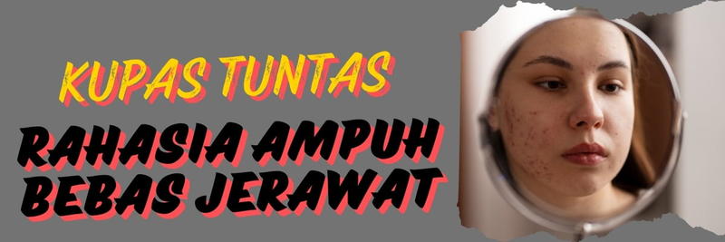 Highlight image for Kupas Tuntas 10 Rahasia Ampuh Bebas Jerawat Paling Murah