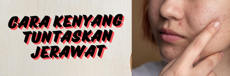 Highlight image for Rahasia Atasi Masalah Jerawat dalam 30 Hari dengan Jus